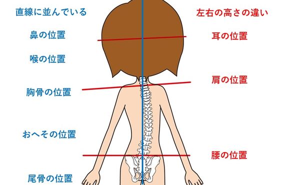 姿勢セルフチェックについて