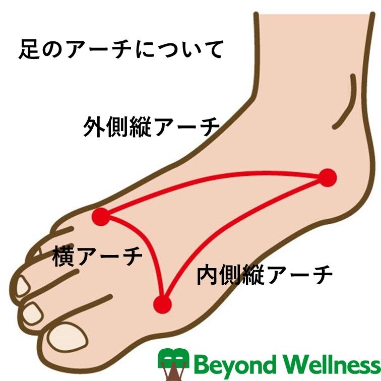 足のアーチ